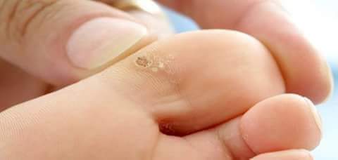 نقره لعرض الصورة في صفحة مستقلة